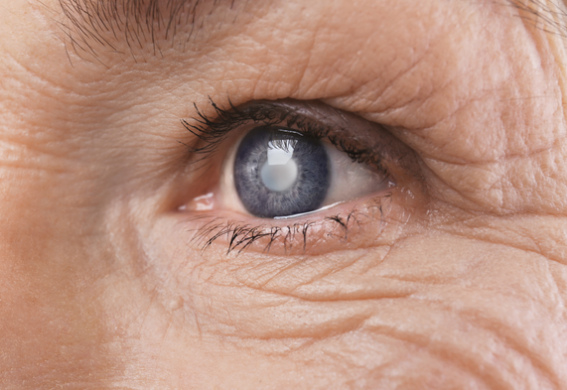 cataract treatment ernakulam